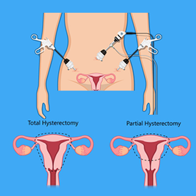 Laparoscopy and Hysteroscopy