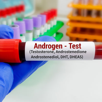 Male Hormone Testing in Karimnagar