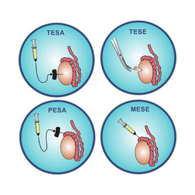 Testicular Mapping in Karimnagar page